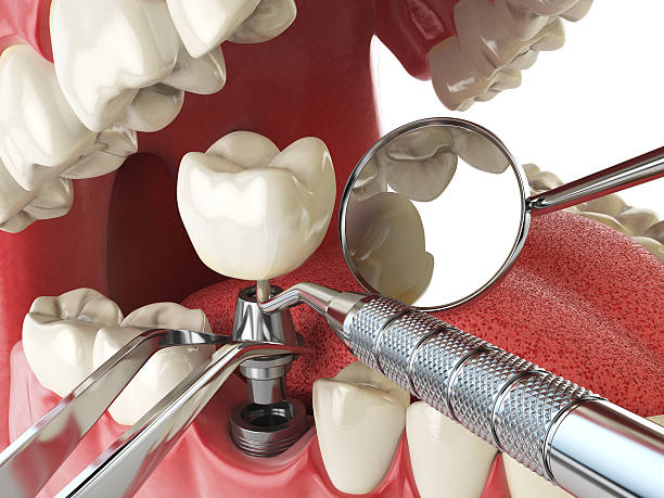 Best Cracked Tooth Emergency Dentist  in USA